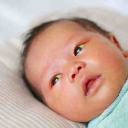 Hesi case study newborn with jaundice