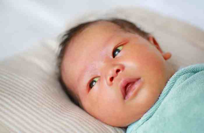 Hesi case study newborn with jaundice