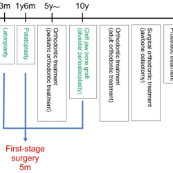 Cleft lip and palate hesi case study