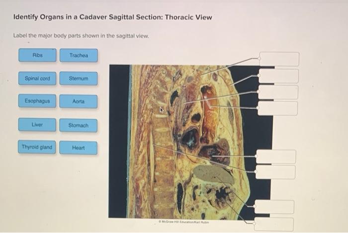 Label the major body parts shown in the sagittal view