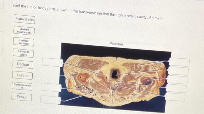 Female body human shown label major parts torso show chegg spleen transcribed text