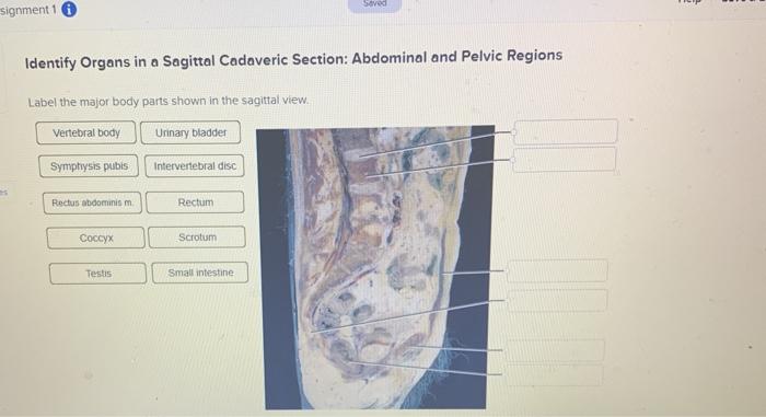 Label the major body parts shown in the sagittal view